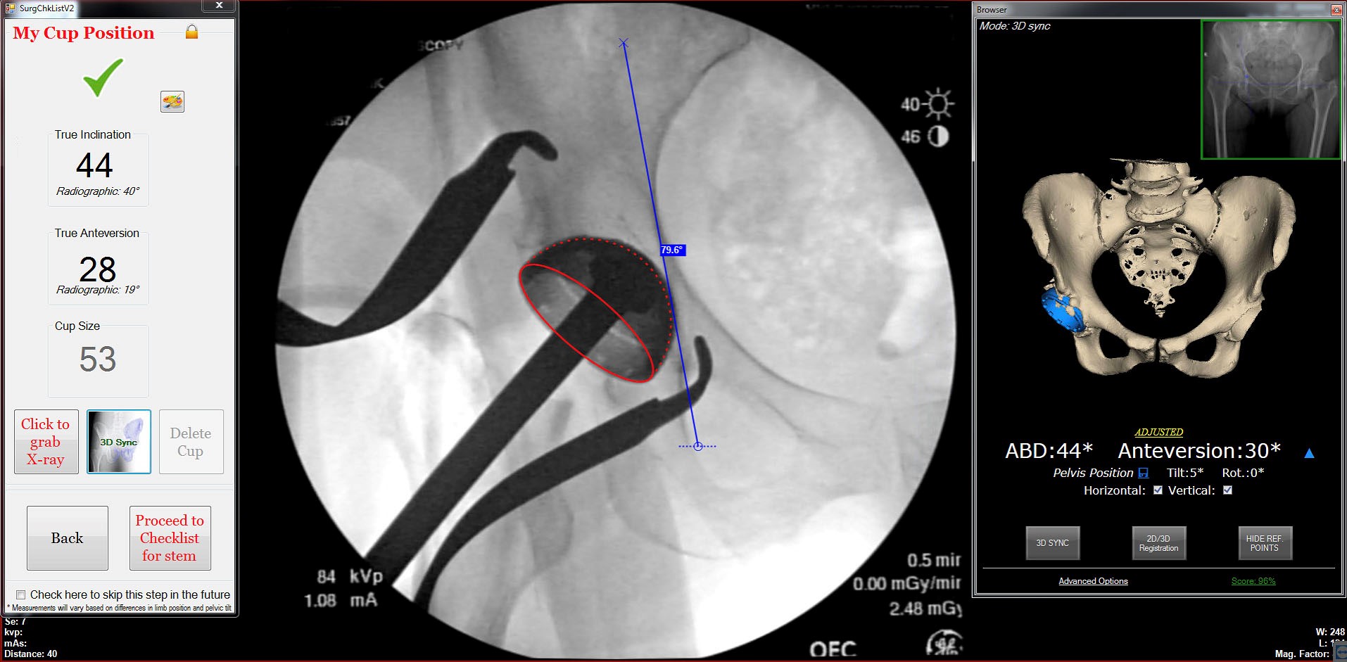 United States Patent and Trademark Office (USPTO) has granted Osteon  Medical their patent for the groundbreaking Nexus iOS technology — Osteon  Medical